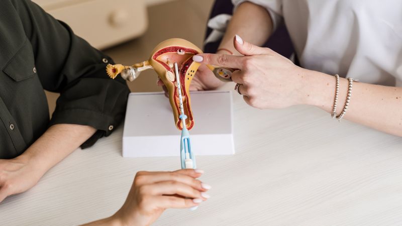 Women called for change around IUD pain. New guidelines say doctors need to help manage itWomen called for change around IUD pain. New guidelines say doctors need to help manage it 